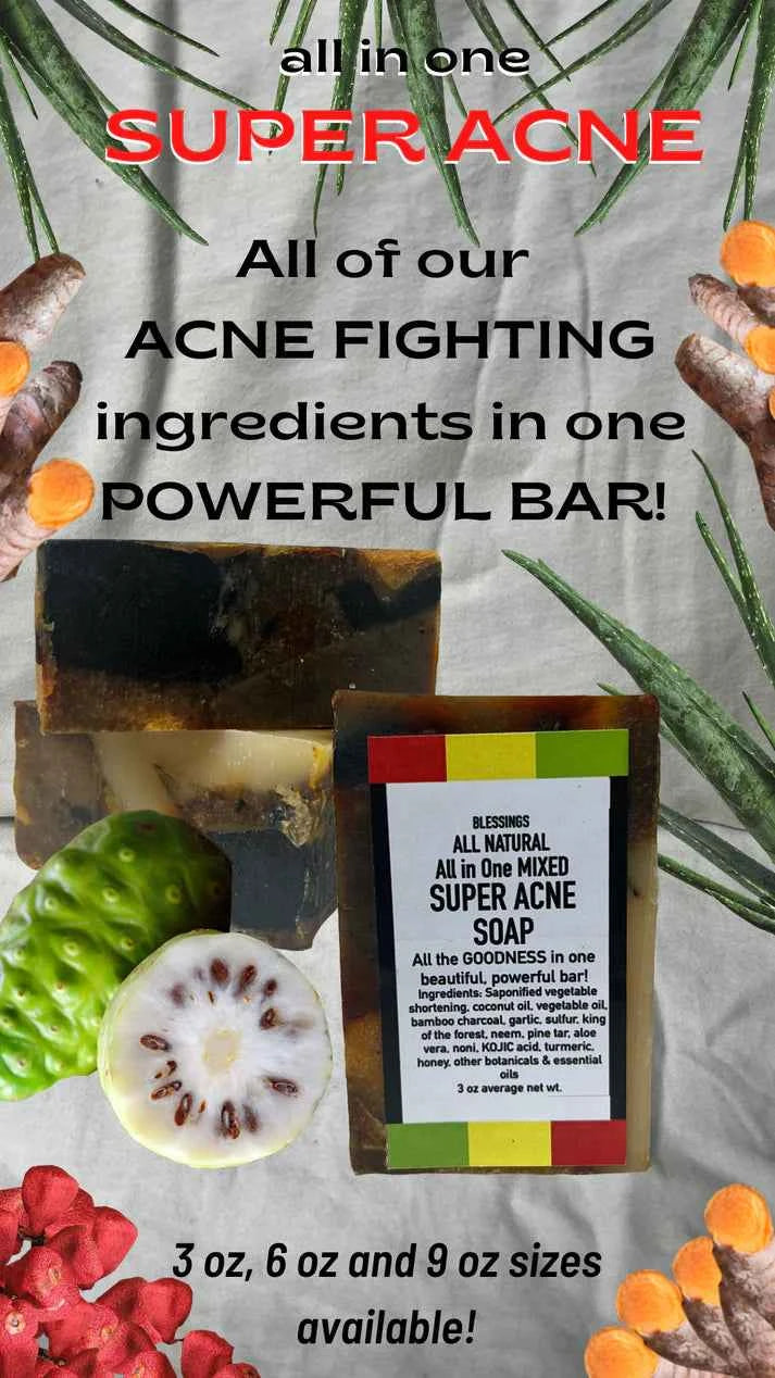 All Natural All In One Mixed Super Acne Soap